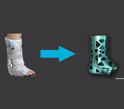 3D打印的足踝康复辅具!