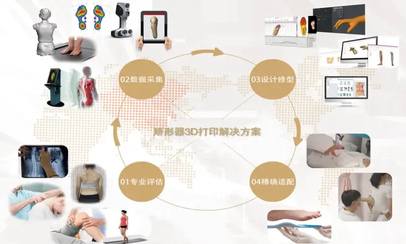 imgi 27 矫形器3D打印解决方案