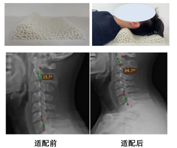 imgi 35 20211210103941148