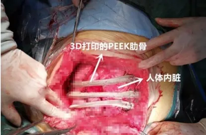 imgi 40 20190211060624748