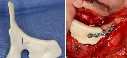 imgi 41 20190211060643343